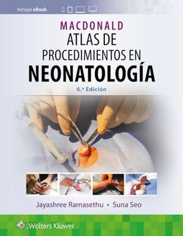 MacDonald. Atlas de procedimientos en neonatologia