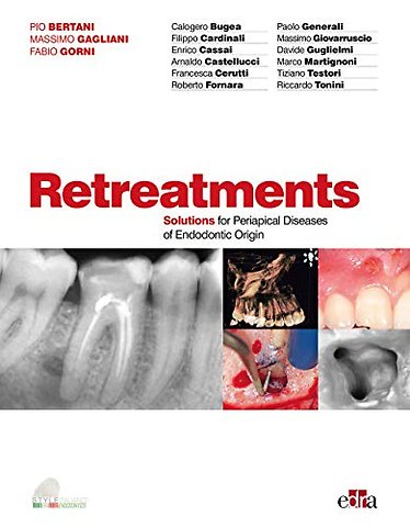 Retreatment. Solutions for apical diseases of endodontic origin