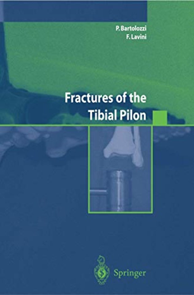 Fractures of the Tibial Pilon