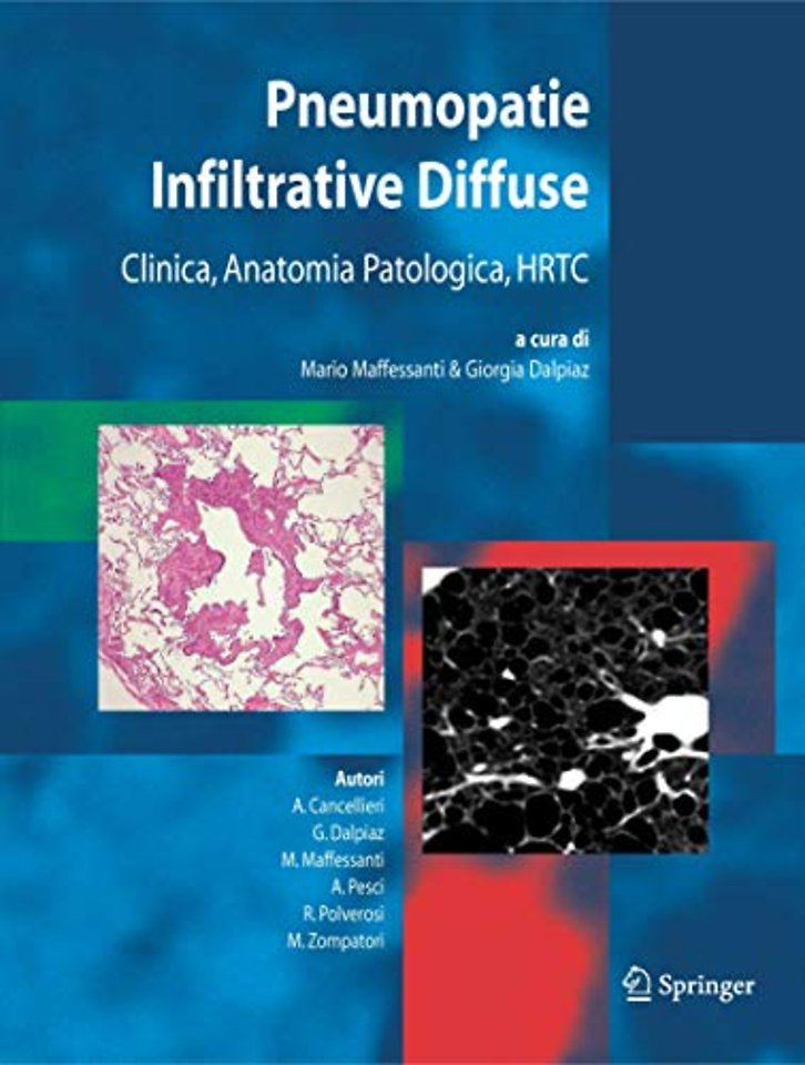Pneumopatie Infiltrative Diffuse