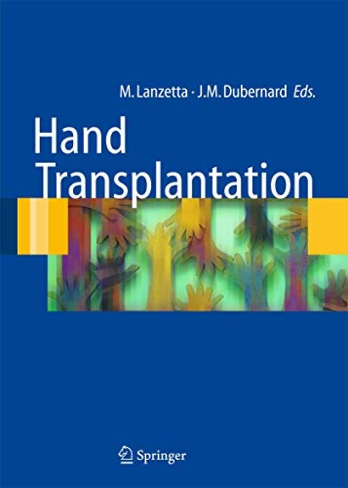 Hand transplantation