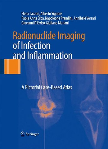 Radionuclide Imaging of Infection and Inflammation