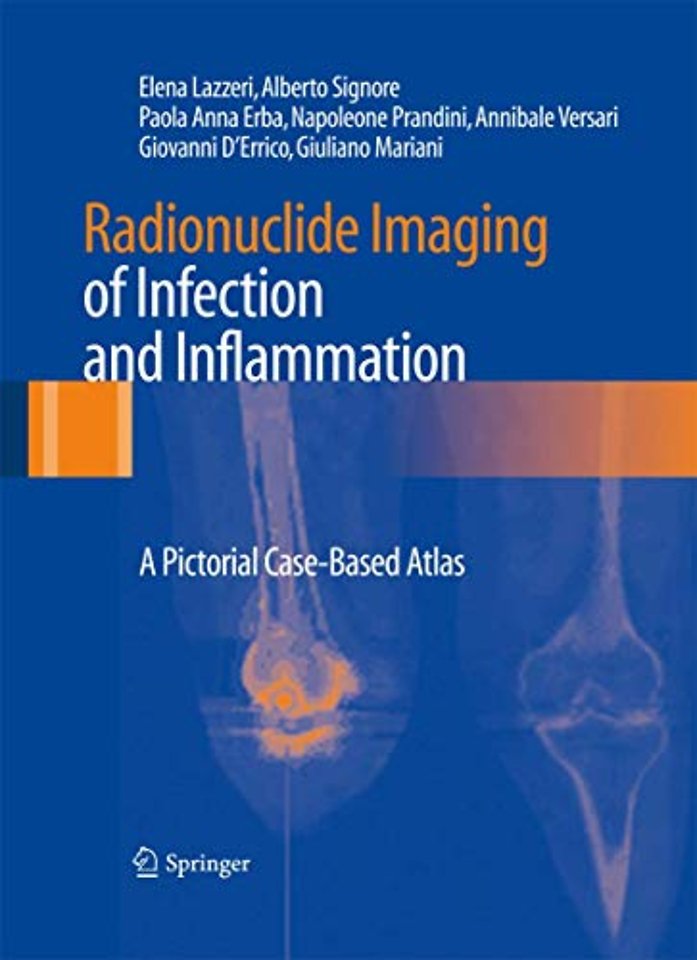 Radionuclide Imaging of Infection and Inflammation