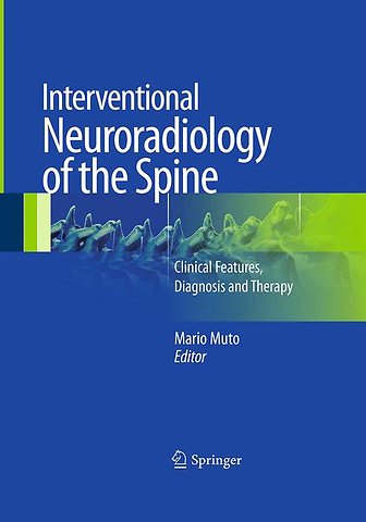 Interventional Neuroradiology of the Spine