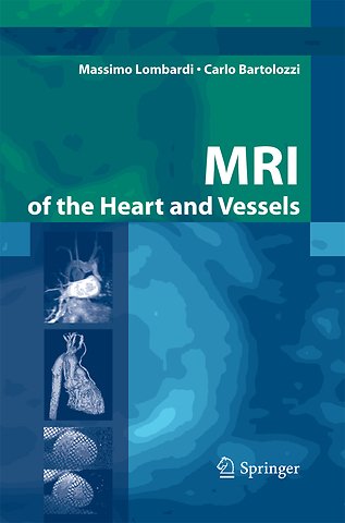 MRI of the Heart and Vessels