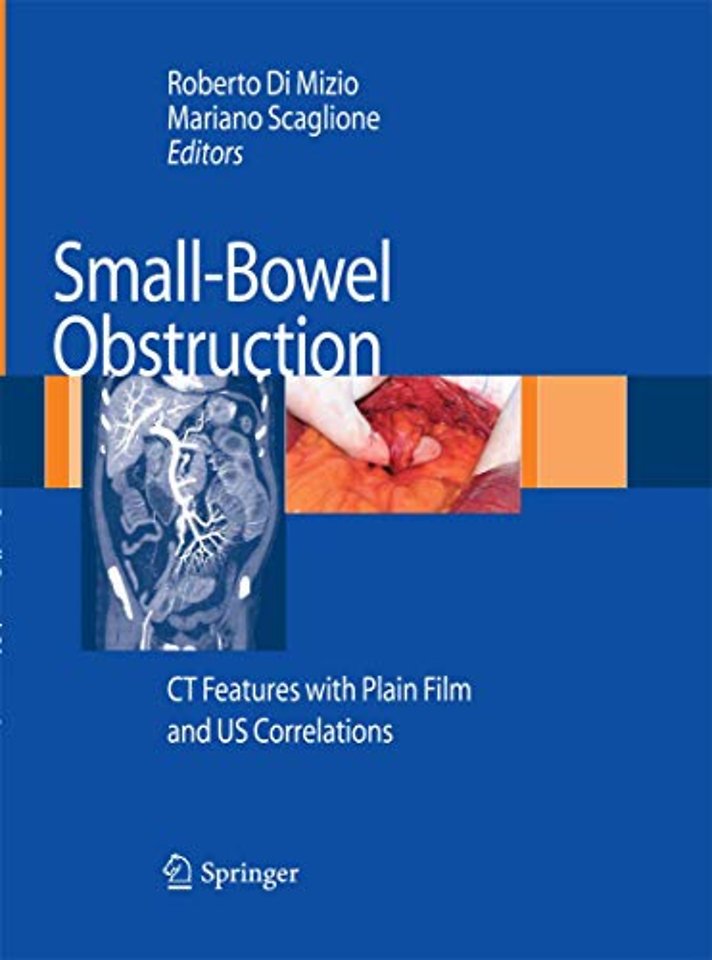 Small-Bowel Obstruction
