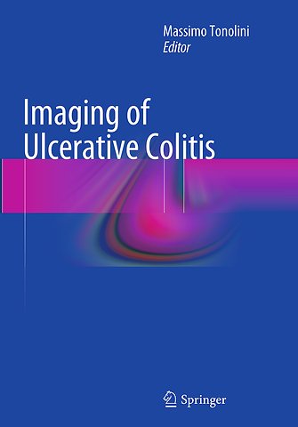 Imaging of Ulcerative Colitis