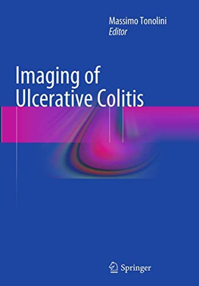 Imaging of Ulcerative Colitis