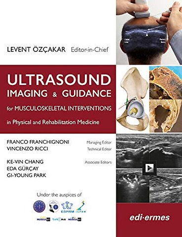Ultrasound Imaging & Guidance for Musculoskeletal Interventions in Physical and Rehabilitation