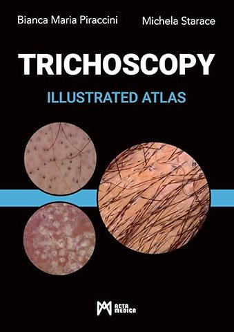 Trichoscopy – Illustrated Atlas