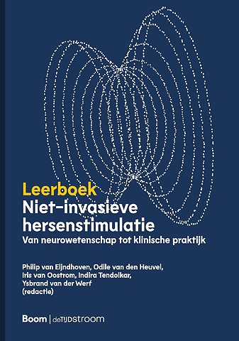 Niet-invasieve hersenstimulatie