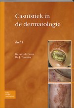 Casuïstiek in de dermatologie deel 1