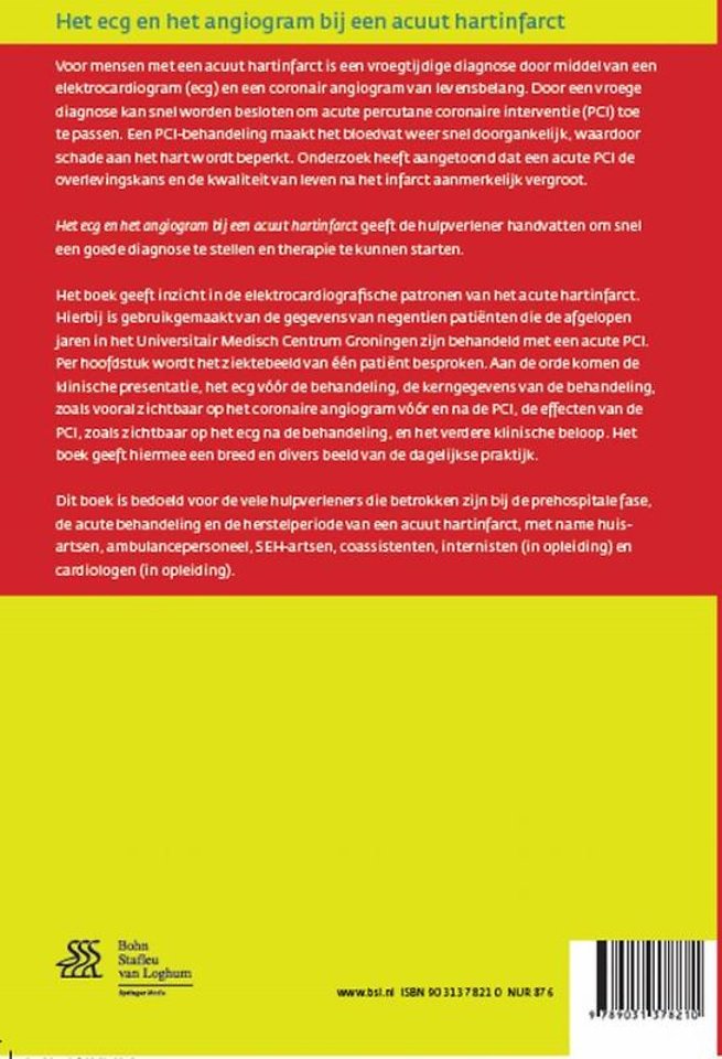 Het ECG en het angiogram bij een acuut hartinfarct