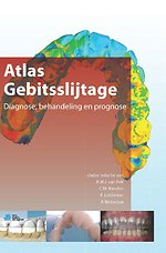 Atlas gebitsslijtage