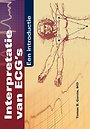 Interpretatie van ECG's