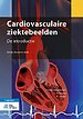 Cardiovasculaire ziektebeelden