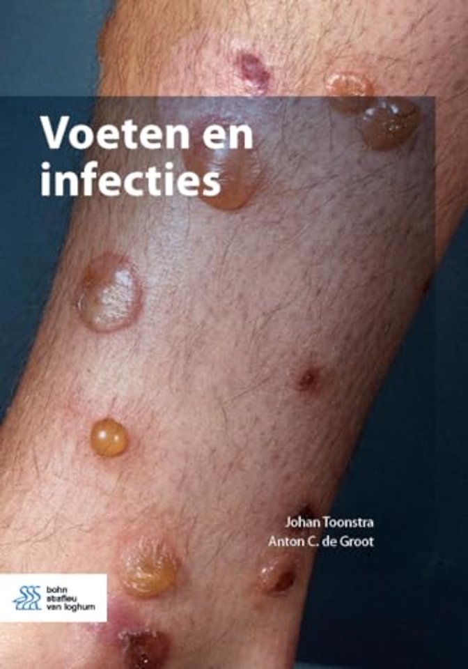 Voeten en infecties