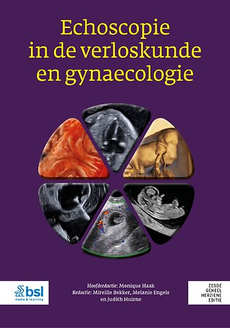 Echoscopie in de verloskunde en gynaecologie