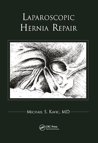 Laparoscopic Hernia Repair