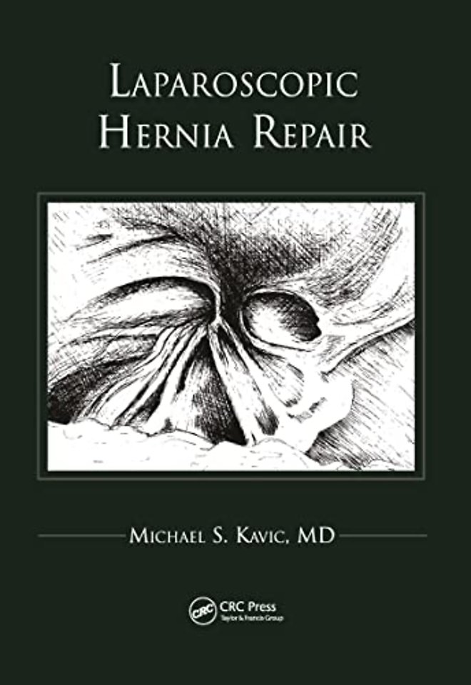 Laparoscopic Hernia Repair