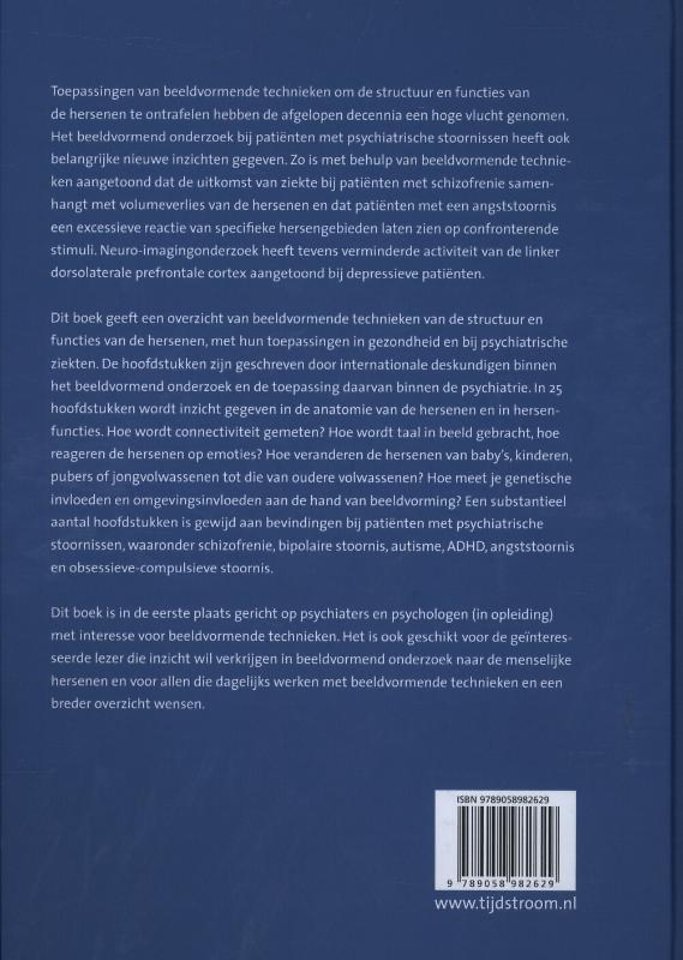 Beeldvorming van het brein