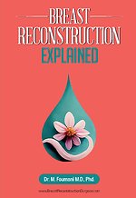 Breast Reconstruction Explained