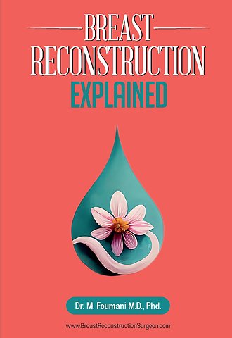 Breast Reconstruction Explained