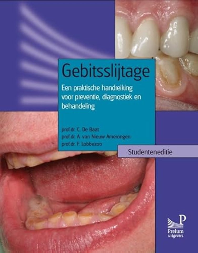 Gebitsslijtage Studenteneditie