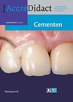 Cementen