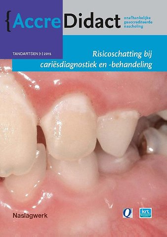 Risicoschatting bij cariësdiagnostiek en -behandeling gebaseerd op risicoschatting
