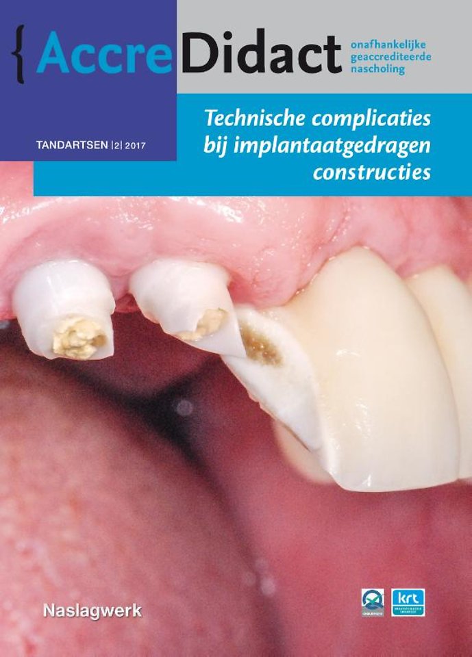 Technische complicaties bij implantaatgedragen constructies