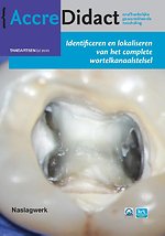 Identificeren en lokaliseren van het complete wortelkanaalstelsel