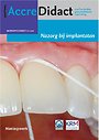 Nazorg bij implantaten Mondhygiënist 2020-1 Nazorg bij implantaten Mondhygiënist 2020-1