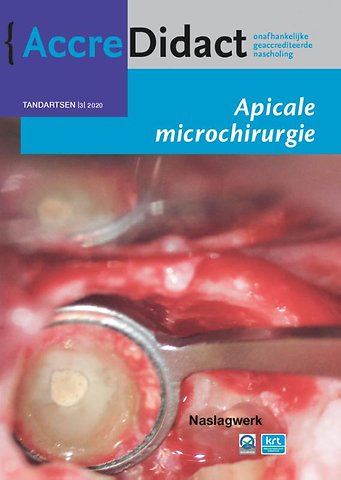 Apicale microchirurgie