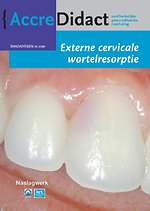 Externe cervicale wortelresorptie