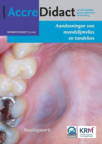 Aandoeningen van mondslijmvlies en tandvlees