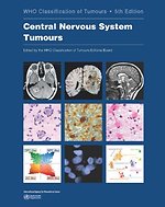 Central Nervous System Tumours