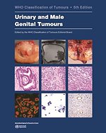 Urinary and Male Genital Tumours