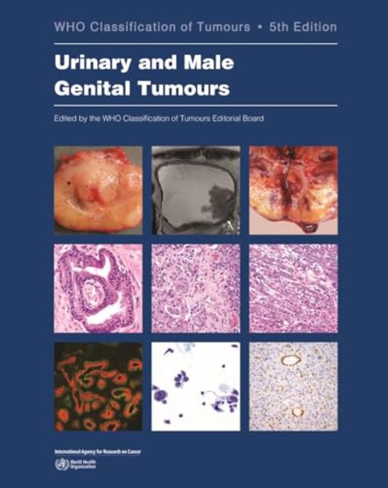 Urinary and Male Genital Tumours