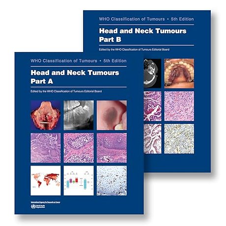 WHO Classification of Head and Neck Tumours