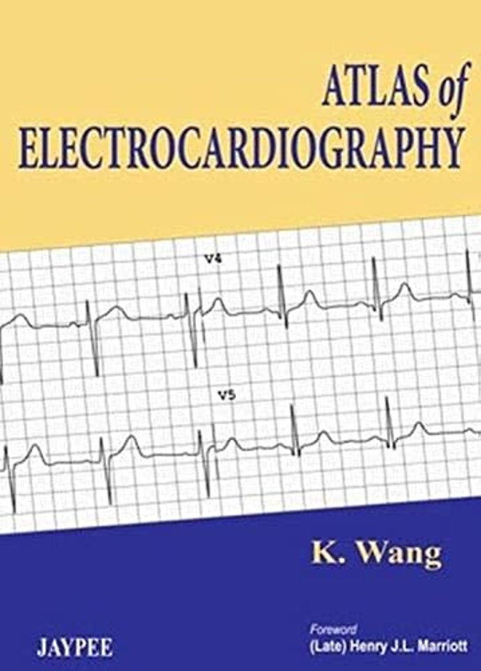 Atlas of Electrocardiography