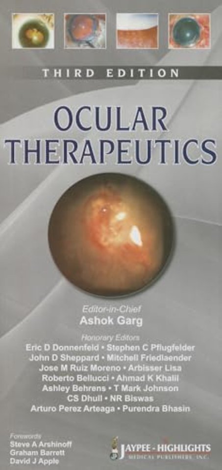 Ocular Therapeutics