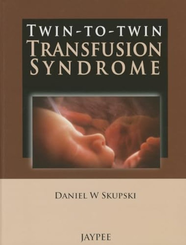 Twin-to-Twin Transfusion Syndrome