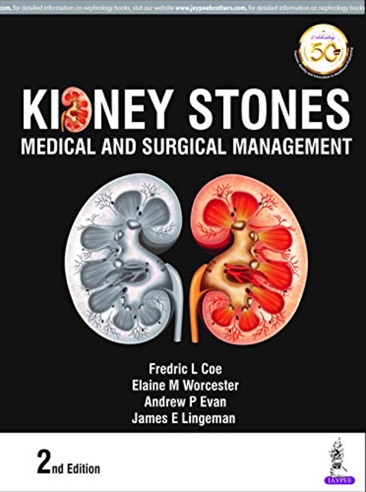 Kidney Stones