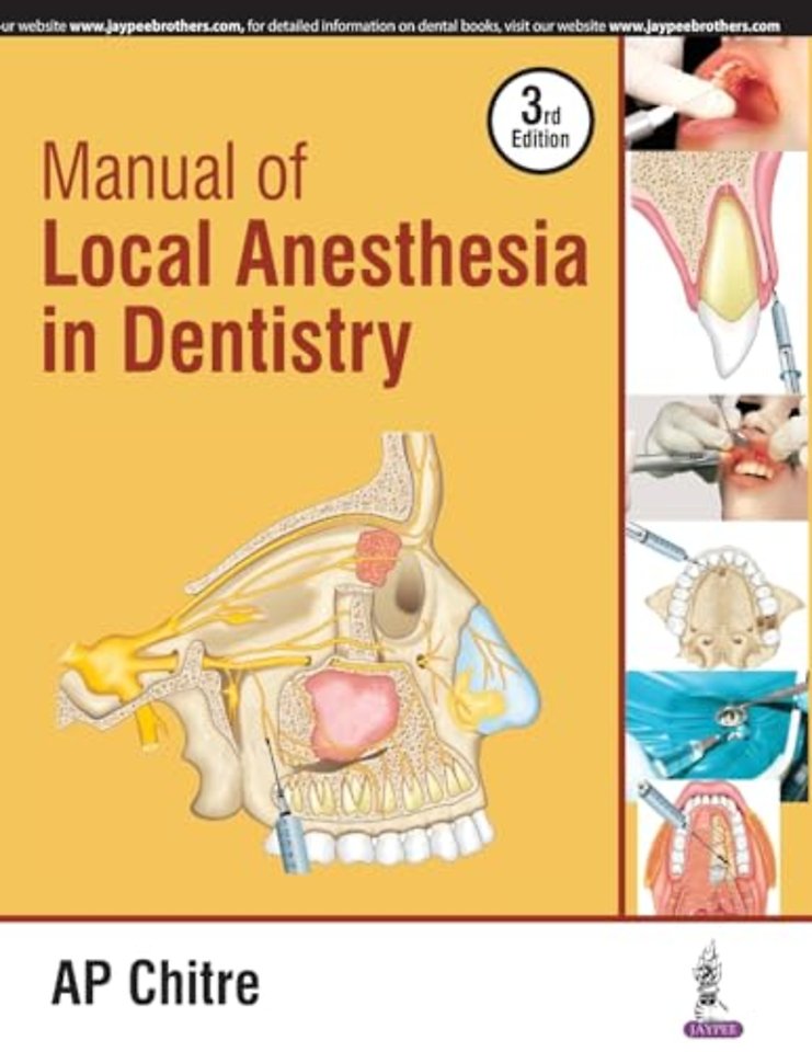 Manual of Local Anaesthesia in Dentistry