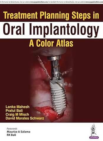 Treatment Planning Steps in Oral Implantology