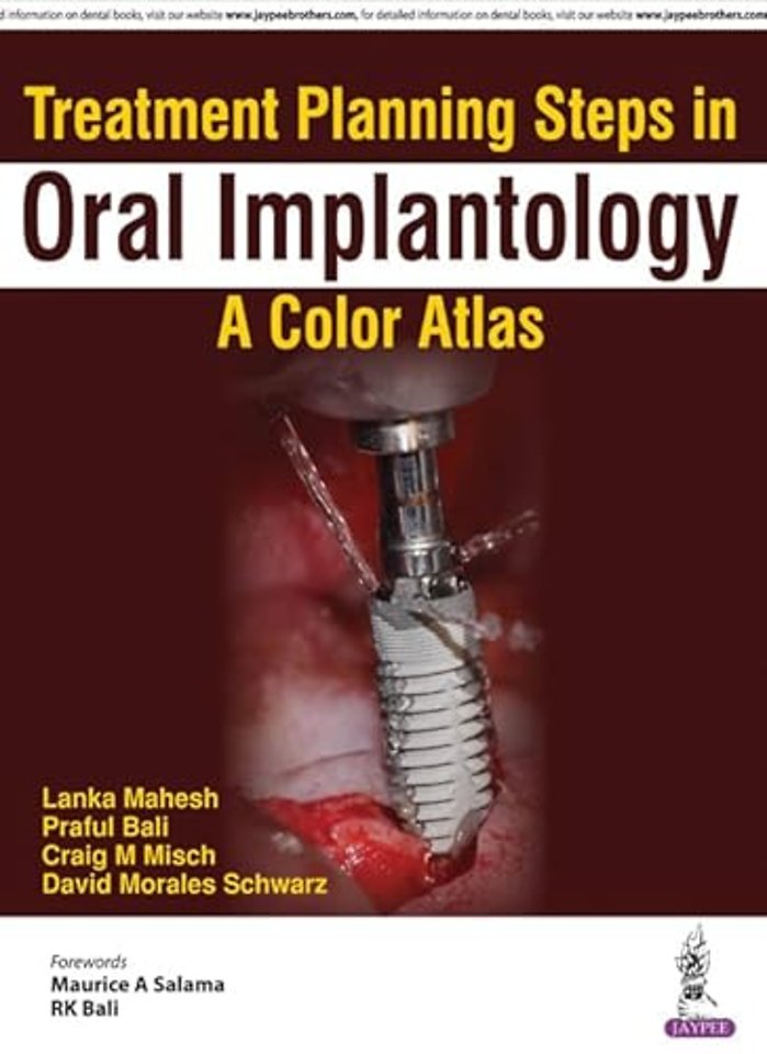 Treatment Planning Steps in Oral Implantology