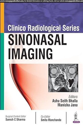 Clinico Radiological Series: Sinonasal Imaging