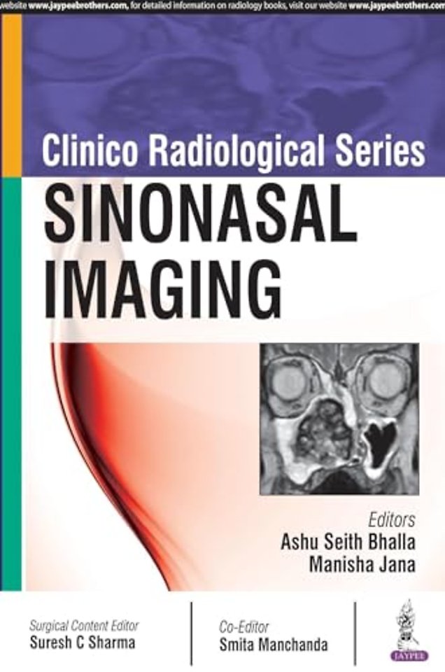 Clinico Radiological Series: Sinonasal Imaging
