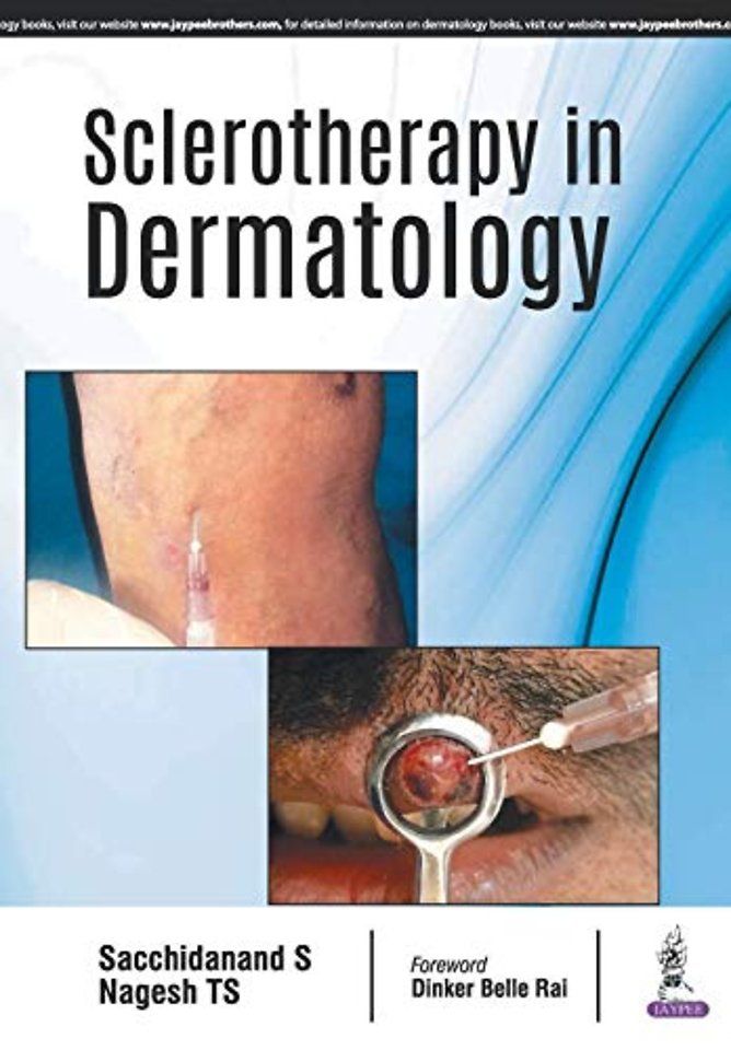 Sclerotherapy in Dermatology